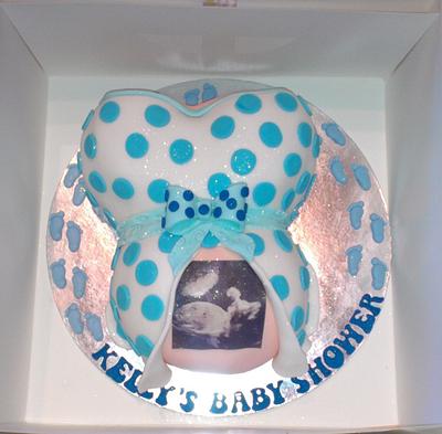 Baby Shower bump and scan pic cake  - Cake by Krazy Kupcakes 