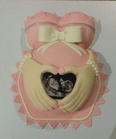 Baby Bump Cake - Cake by Veronica - @cakeuvee 