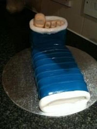 foot cast cake! - Cake by annaliese