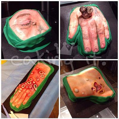 Medical Moulages  - St John's Institute of Dermotology - Cake by Caking it.