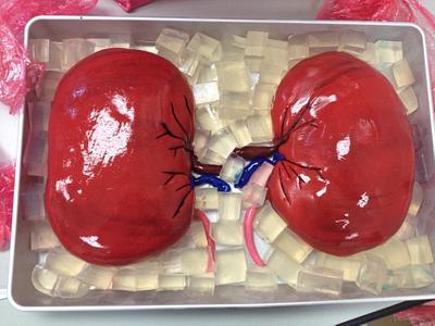 Organ Donor Cake! - Cake by Julia