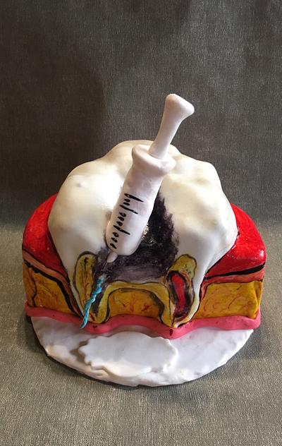 Dentist cake - Cake by Doroty