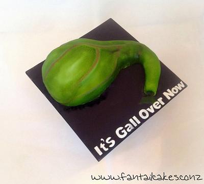It's a Gall Bladder - Cake by Fantail Cakes