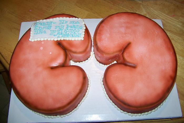 Kidney Groom's Cake