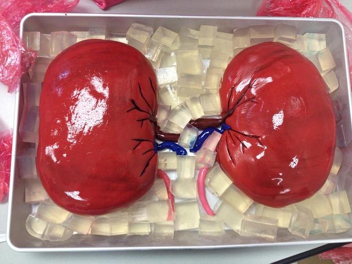 Organ Donor Cake!