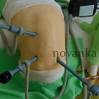 A knee operation cake